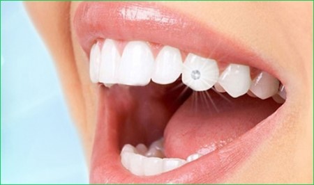 NHA KHOA TẠI QUẬN 10 NHA KHOA TẠI QUẬN 10